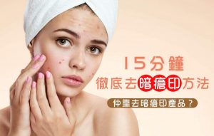 去暗瘡印方法
