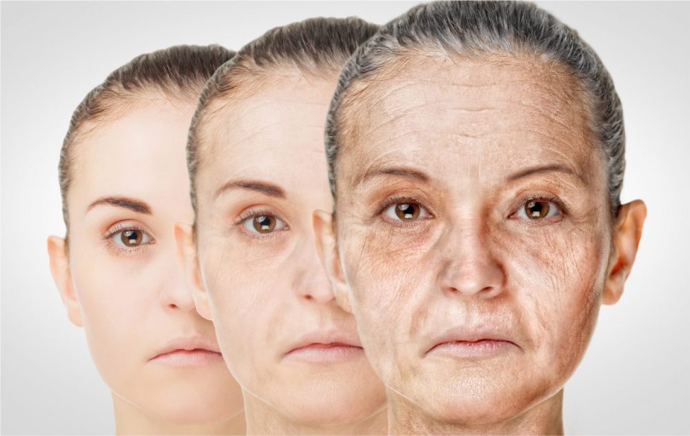 收細毛孔方法-肌膚老化