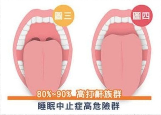 【鼻鼾原因】鼻鼾聲好大怎樣解決!? 即學10招止鼻鼾方法!| Beauty Place